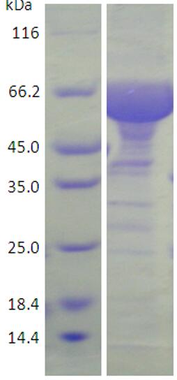 15% SDS-PAGE analysis profiles of purified KP_0953-31-675 (CBB stained).